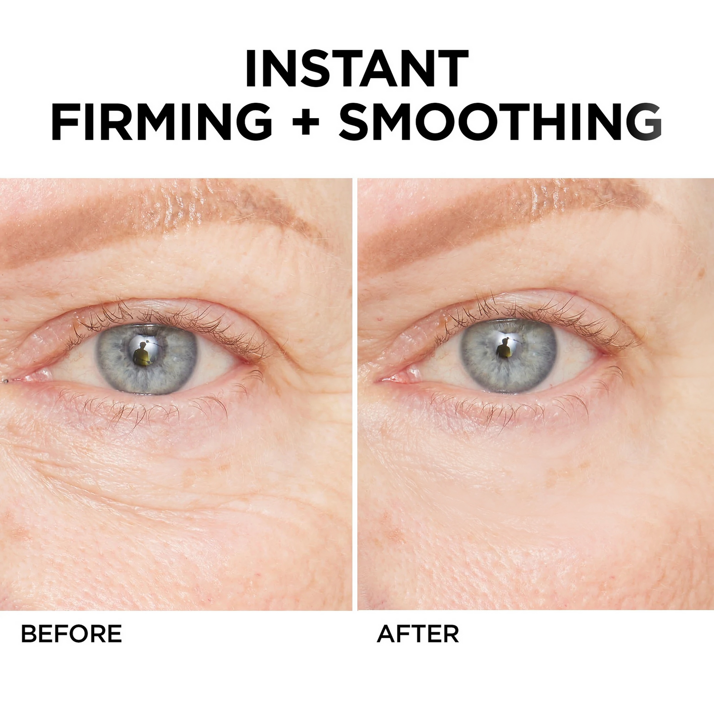💯Lovilds™🔥Instant Wrinkle Eye Tightener-crème