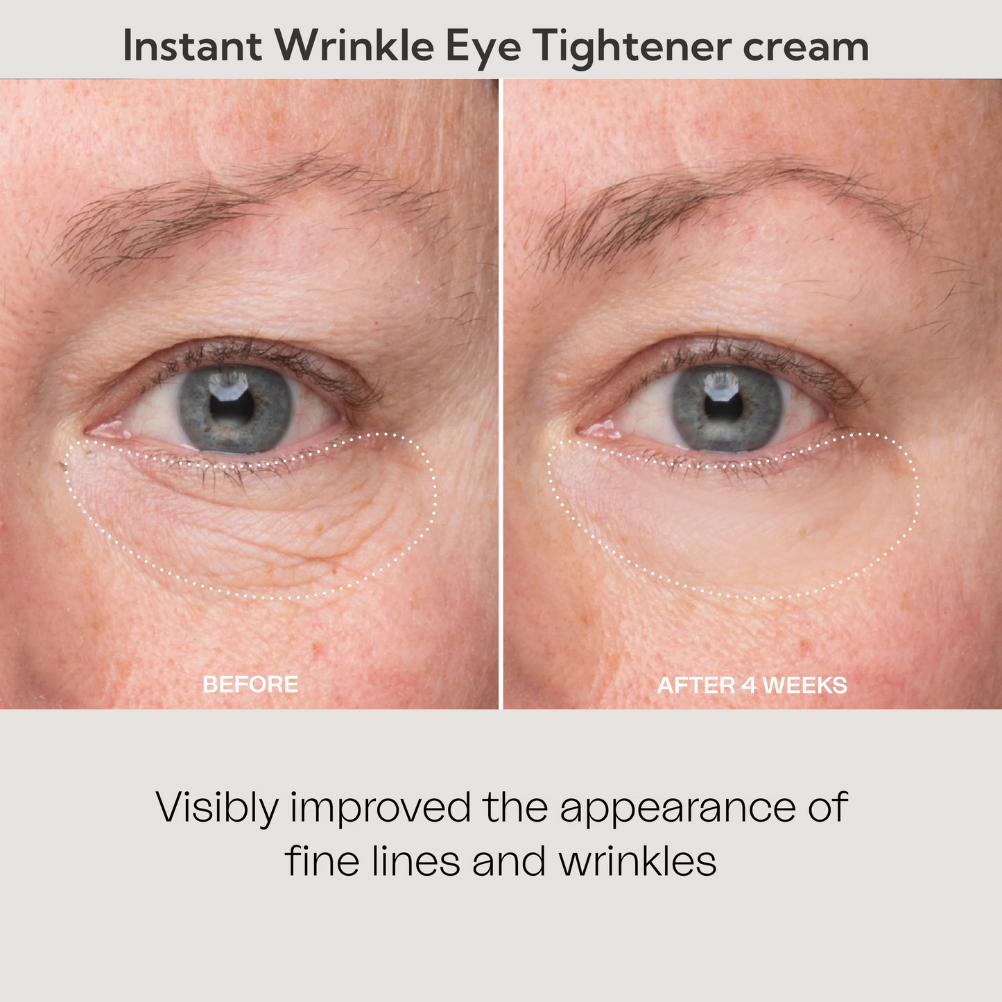 💯Lovilds™🔥Instant Wrinkle Eye Tightener-crème