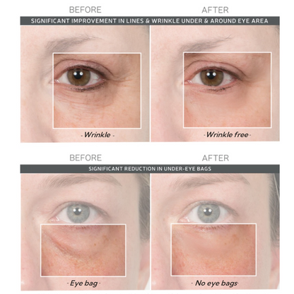 💯Lovilds™🔥Instant Wrinkle Eye Tightener-crème