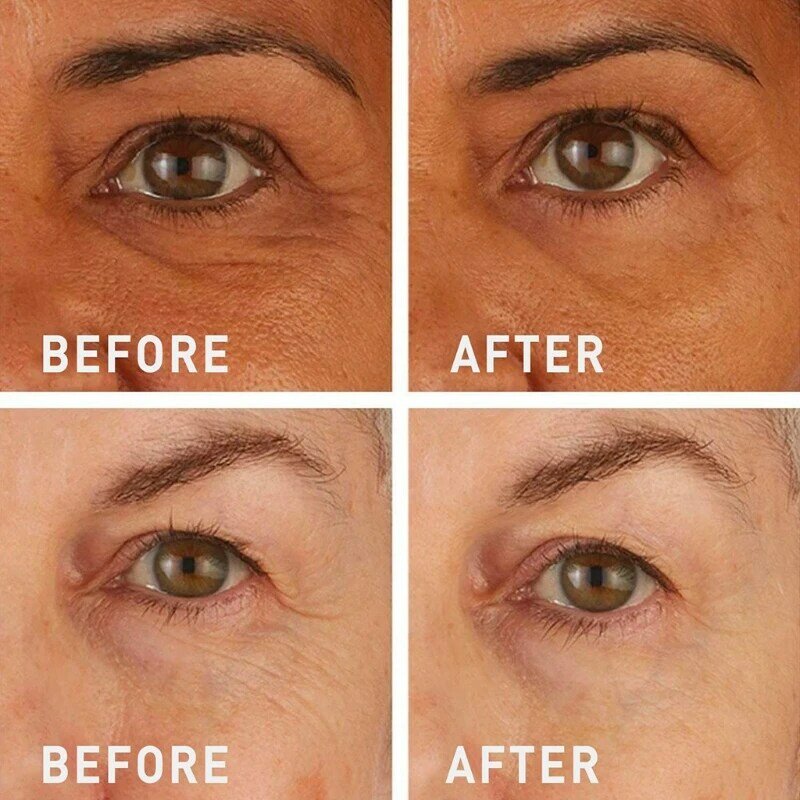 💯Lovilds™🔥Instant Wrinkle Eye Tightener-crème