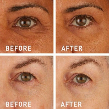 💯Lovilds™🔥Instant Wrinkle Eye Tightener-crème