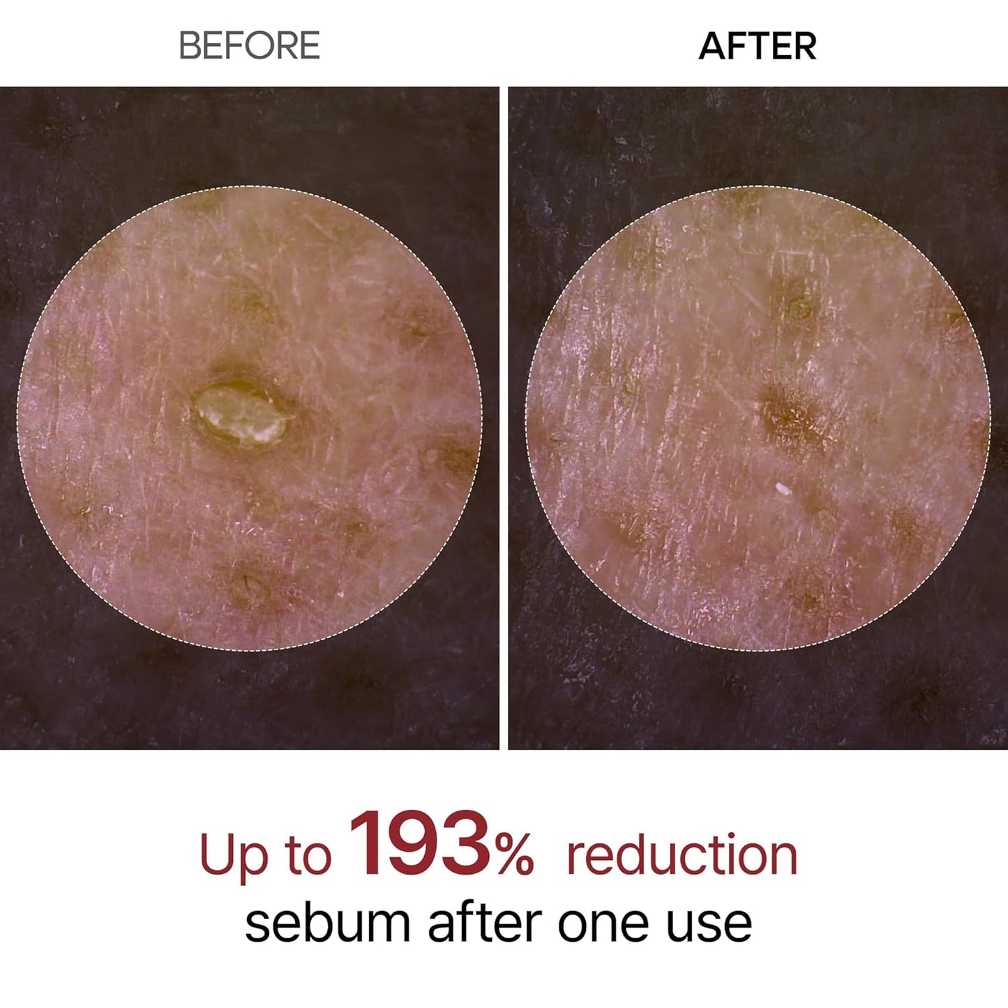 Exfoliating Rice Peel Duo – Instantly Removes Dead Skin for Smooth, Glowing Skin