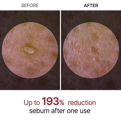 Exfoliating Rice Peel Duo – Instantly Removes Dead Skin for Smooth, Glowing Skin